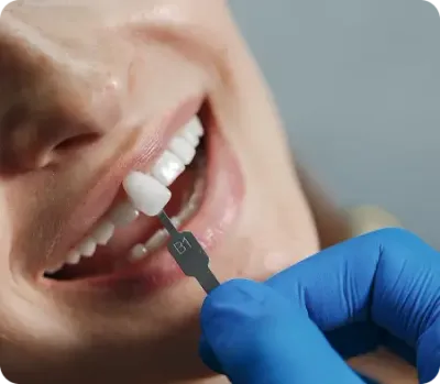 Dentist removing a patient’s tooth with forceps