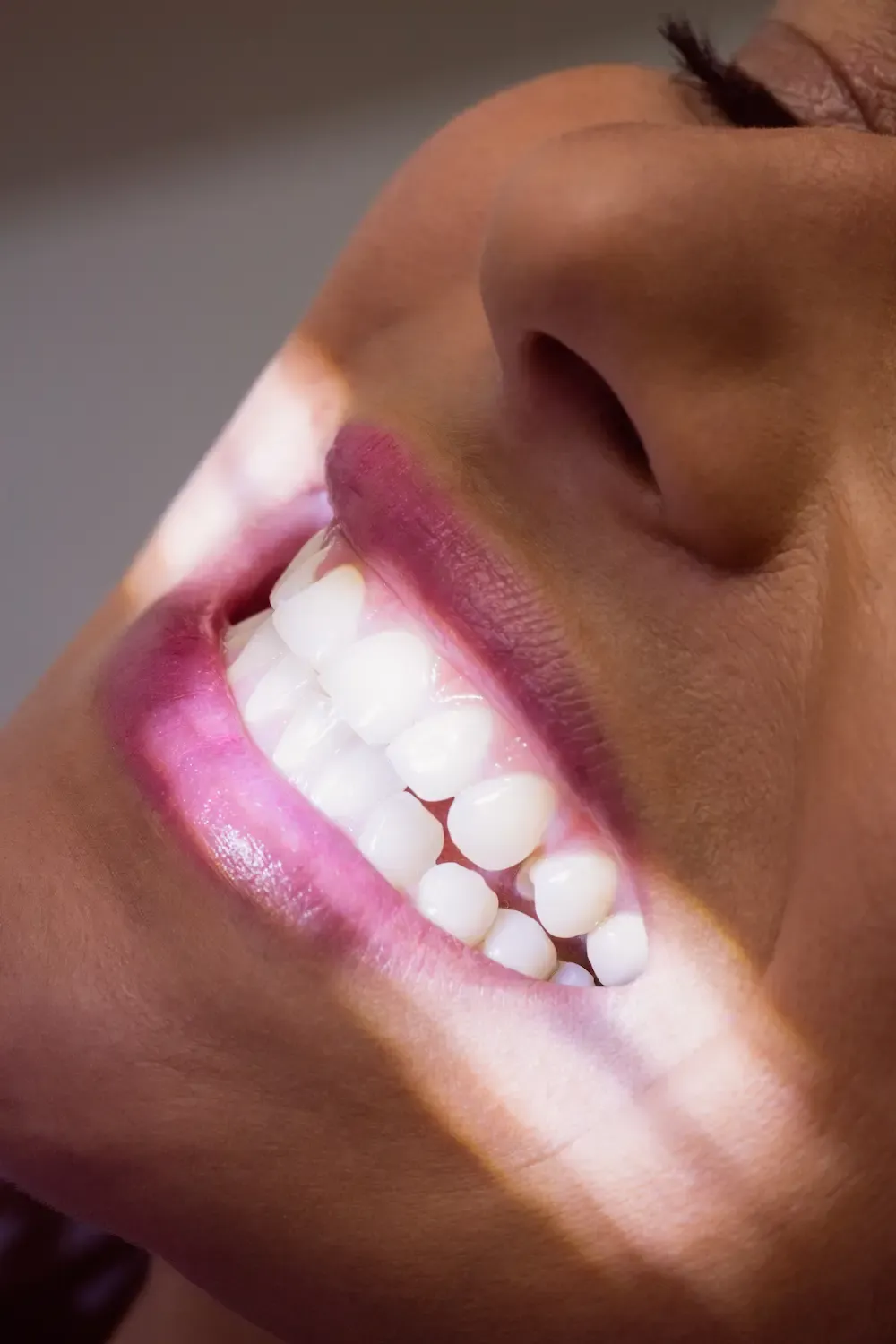 Person smiling with perfectly white teeth under sunlight, showcasing professional teeth whitening results.